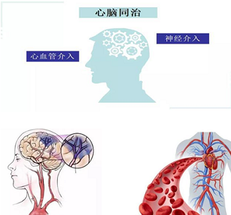 环球在线直播：云南大学附属医院开展 心脑一体化联合救治及MDT门诊